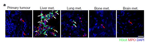 转入小鼠模子获得相同的试验效果，且在转移爆发前NET已在肝脏聚积。。