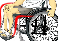 Nature：还瘫痪患者一个自由身的日子不远了