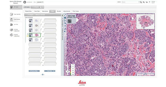 Leica--eSlide剖析治理软件