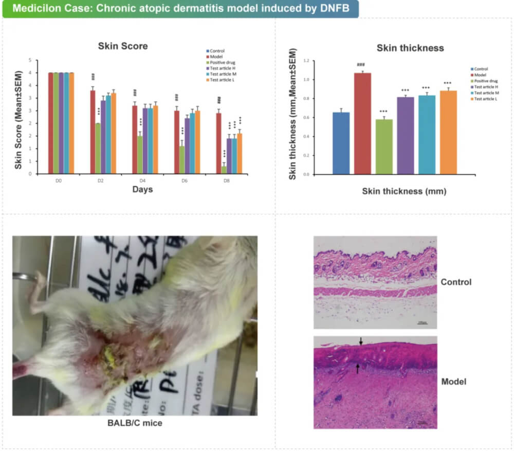 09 DNFB诱导的慢性特应性皮炎模子.jpg